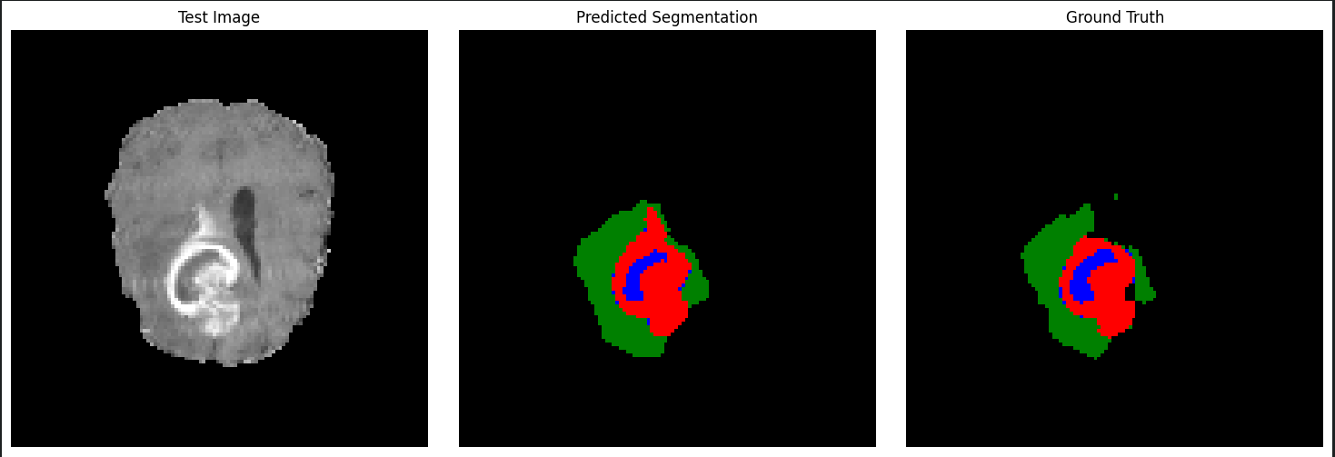 Brain Tumor Segmentation Inference